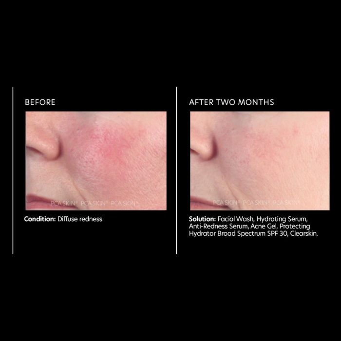 before and after