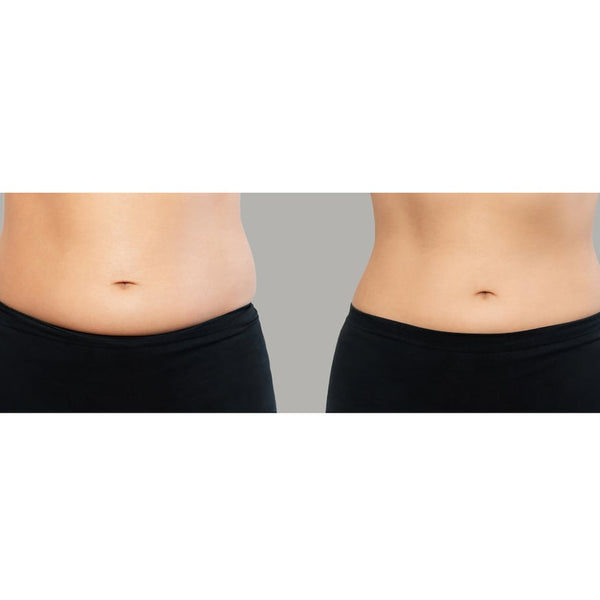 FOREO FAQ 411 Microcurrent Red LED Body Toning Device