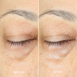 Before and after comparison of eye area skin texture on a person's face.