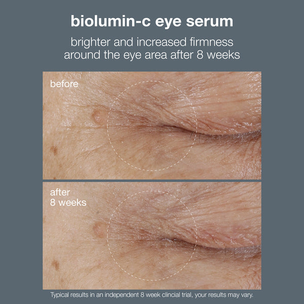 Dermalogica BioLumin-C Eye Serum Buy Online Today | Face the Future