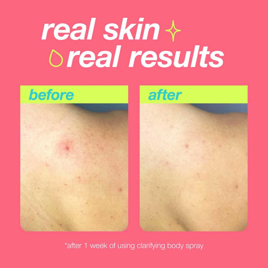 Dermalogica Clarifying Body Spray results