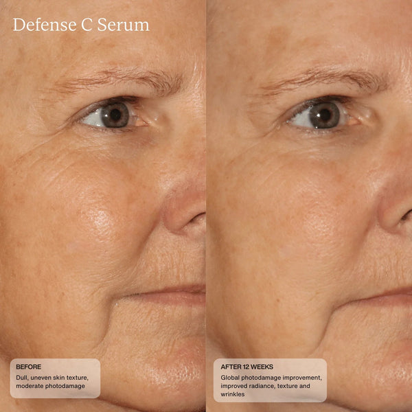 Senté Defense C Serum