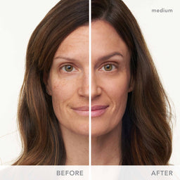 Before and after comparison of a woman's face with medium skin tone.
