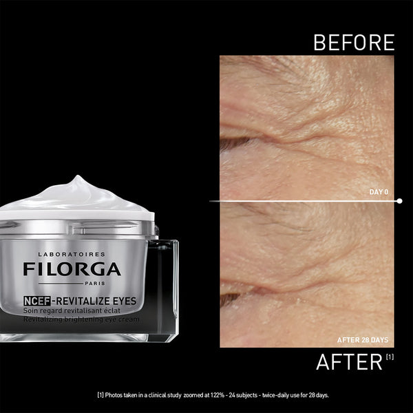 Filorga NCEF Revitalize Eyes cream with 'Before' and 'After' skin texture comparison on a black background