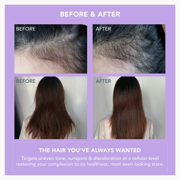 A before-and-after comparison graphic showing hair growth and length results. The top row shows close-up scalp images labeled BEFORE and AFTER, while the bottom row shows a woman from behind with shorter brown hair on the left and longer, smoother brown hair on the right.