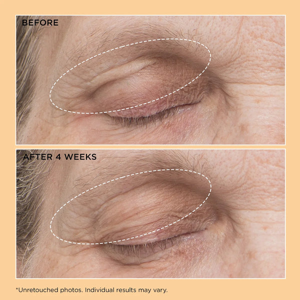 Perricone MD Neuropeptide Eyelid Lift Serum 15ml