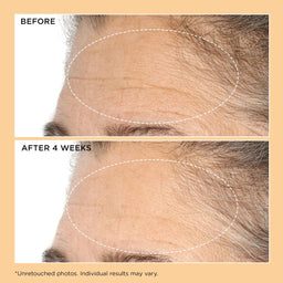 Perricone MD Neuropeptide Deep Crease Serum 30ml