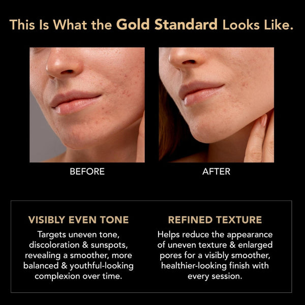 A before-and-after skincare comparison graphic showing close-up views of a woman's lower face and neck, with text claiming visible even tone and refined texture. The layout is on a black background with gold and white text.