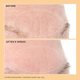 Perricone MD Neuropeptide Deep Crease Serum 30ml