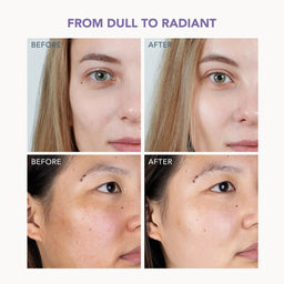 Before and after skin comparison collage showing two women's faces with the text 'FROM DULL TO RADIANT' at the top, demonstrating skincare or cosmetic results.