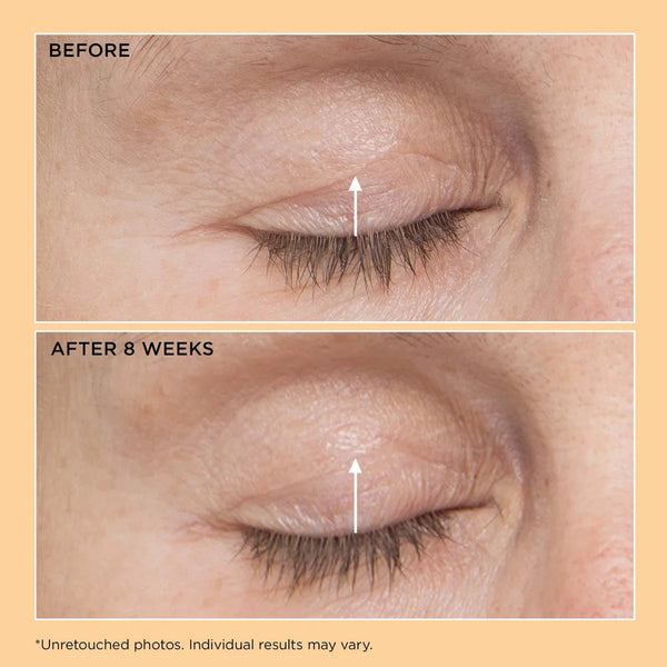 Perricone MD Neuropeptide Eyelid Lift Serum 15ml