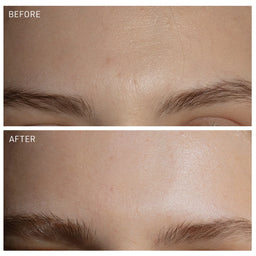 Before and after comparison of a skin treatment on a person's face.
