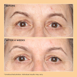 Perricone MD Neuropeptide Corrective Brightening Under-Eye Cream 15ml