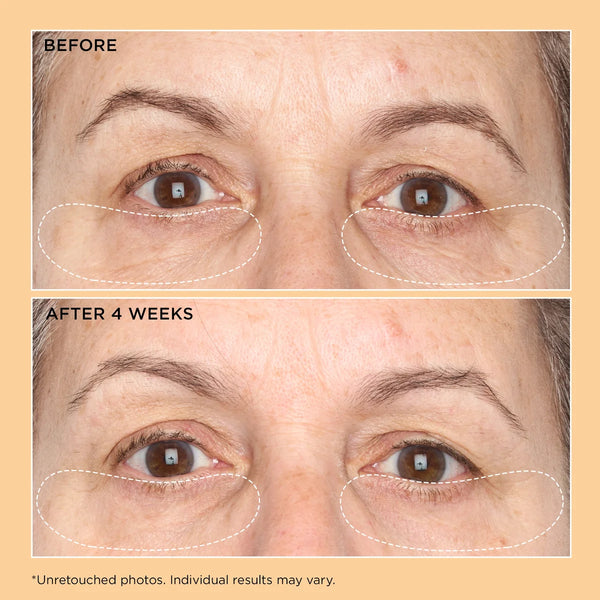 Perricone MD Neuropeptide Corrective Brightening Under-Eye Cream 15ml