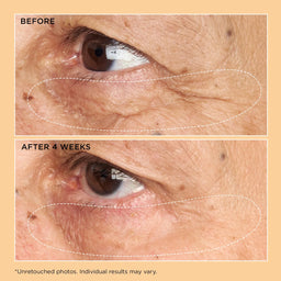 Perricone MD Neuropeptide Corrective Brightening Under-Eye Cream 15ml