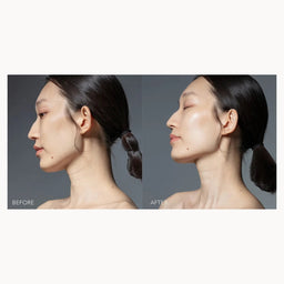Before and after side-profile comparison of a woman's face and neck, showing a skincare or cosmetic treatment result on a light gray background.