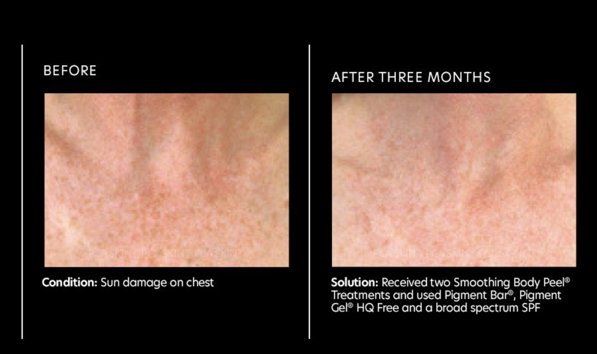 before and after