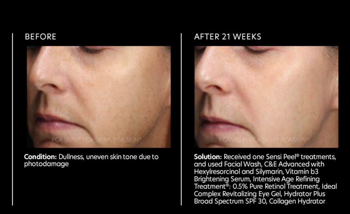 before and after