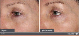Environ Youth EssentiA (C-Quence) Vita-Peptide Eye Gel before and after