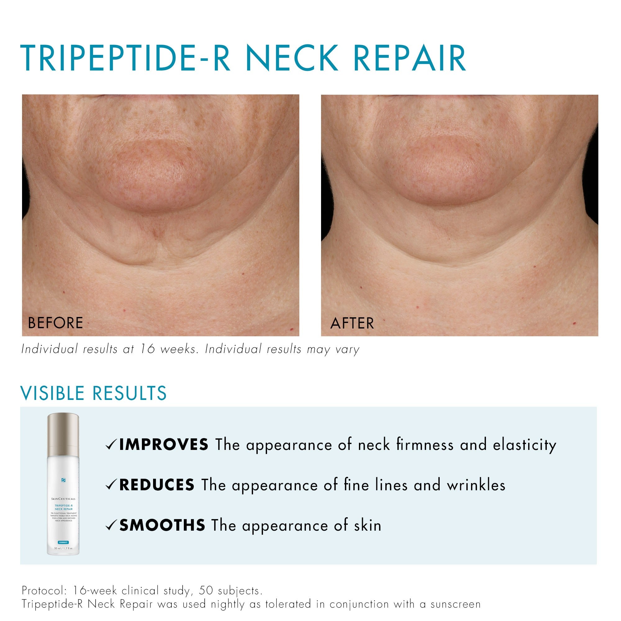 SkinCeuticals Tripeptide-R Neck Repair | Face the Future
