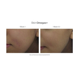 A before and after 12 weeks of using the product revealing an improved skin condition