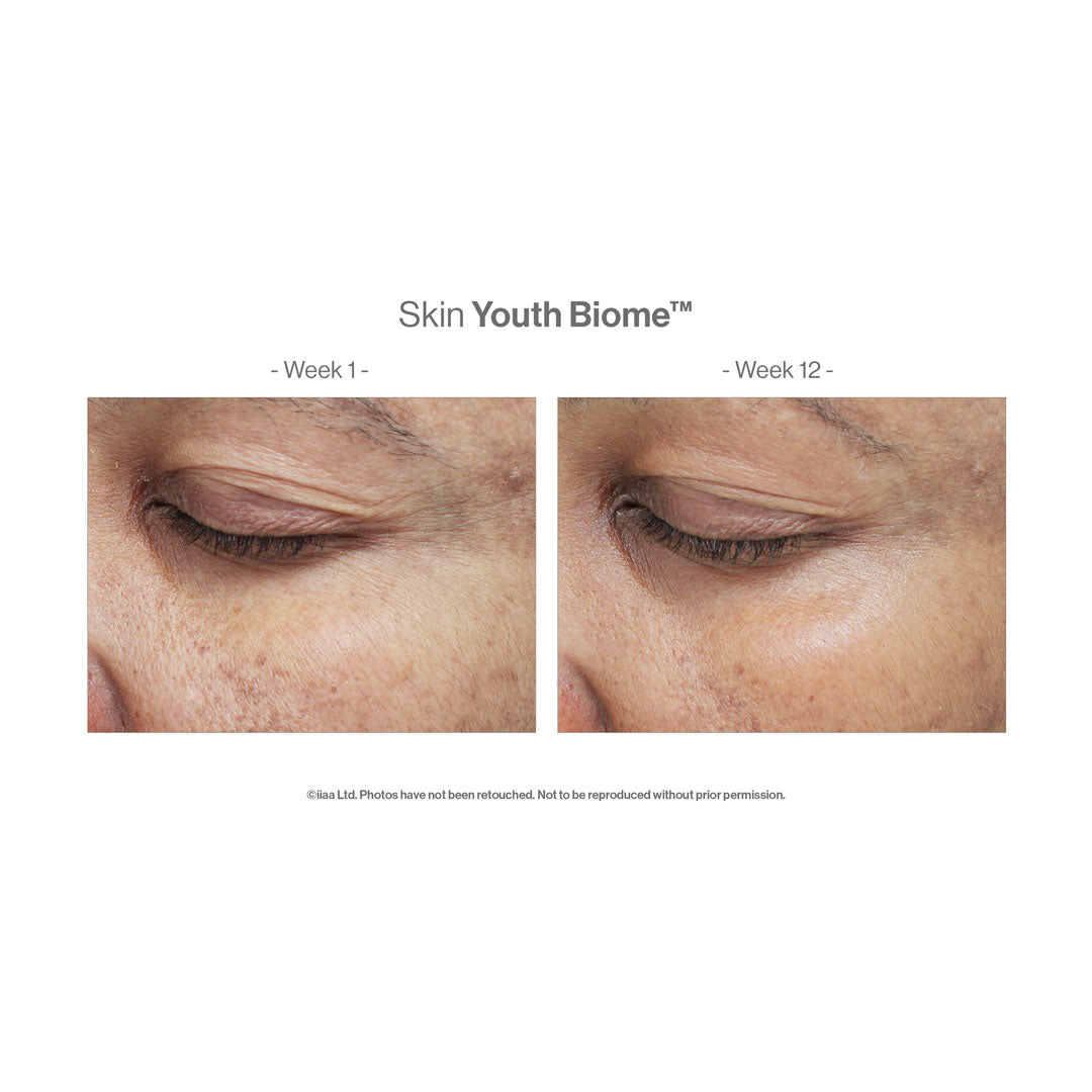 A before and after 12 weeks of using the product showing an improved skin condition