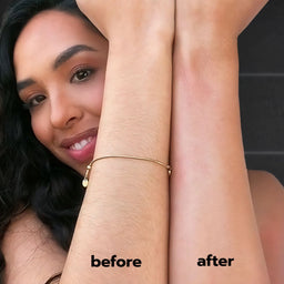 Before and after using ANSWR Exfoliating Hair Removal Drop