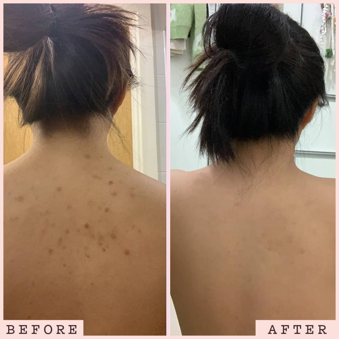 before and after