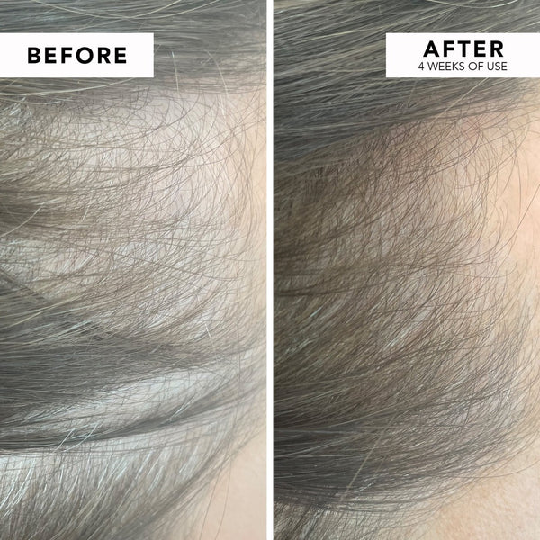 WE ARE PARADOXX Growth Advanced Scalp Serum 50ml before and after