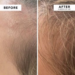 WE ARE PARADOXX Growth Advanced Scalp Serum 50ml before and after